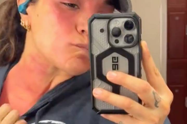 Raquel Rodriguez Opens Up About Mast Cell Activation Syndrom...