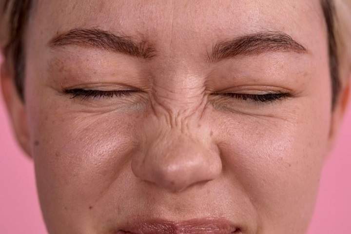 Some Remedies for Acne problem |