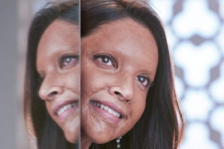 Chhapaak Box Office Collection | Day Wise | Worldwide