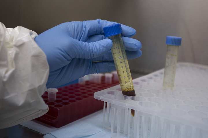 Time to take Homeopathy in corona fight, say experts