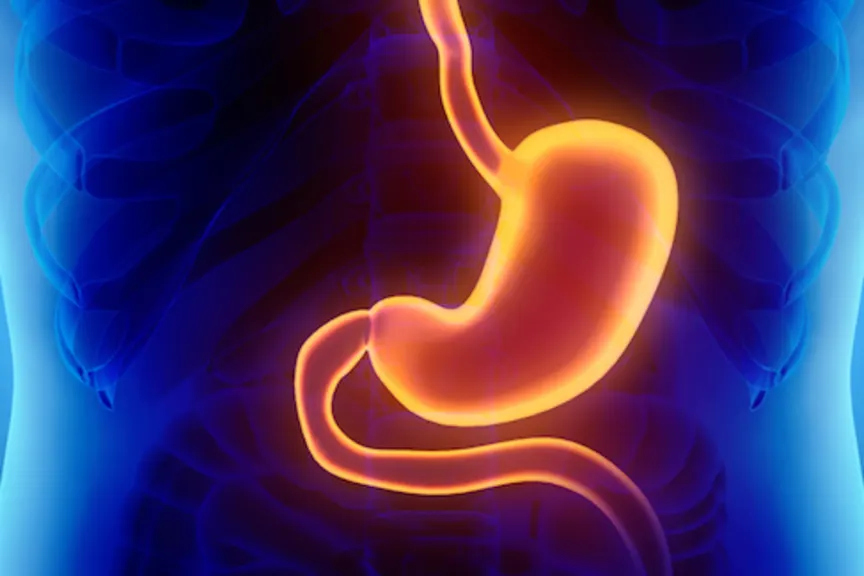 HYPERACIDITY(AMLA PITTA)-CAUSES,SYMPTOMS AND MANAGMENT ACOOR...